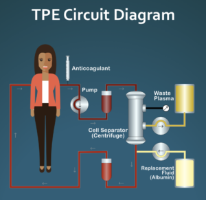 Therapeutic plasma exchange